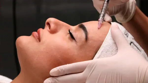 Aplicación de PRDN de salmón con microagujas en el rostro