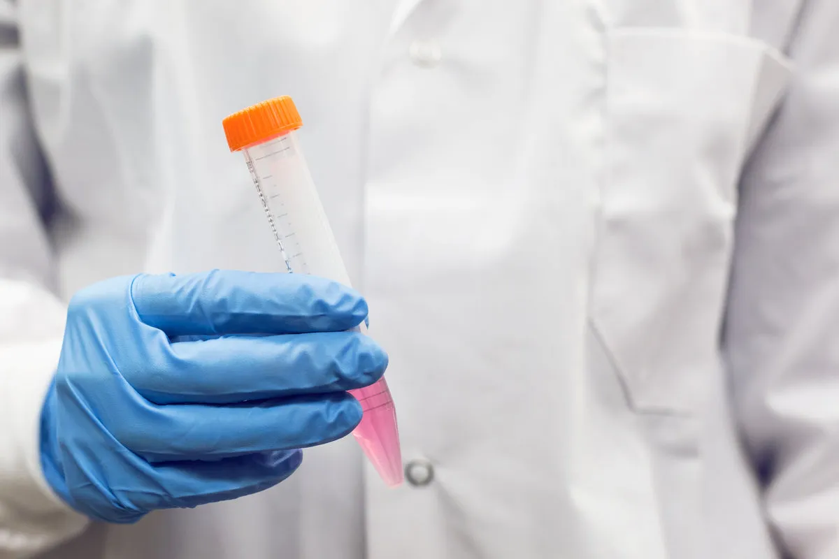 Tubo de muestra y guantes para un tratamiento de plasma rico en plaquetas